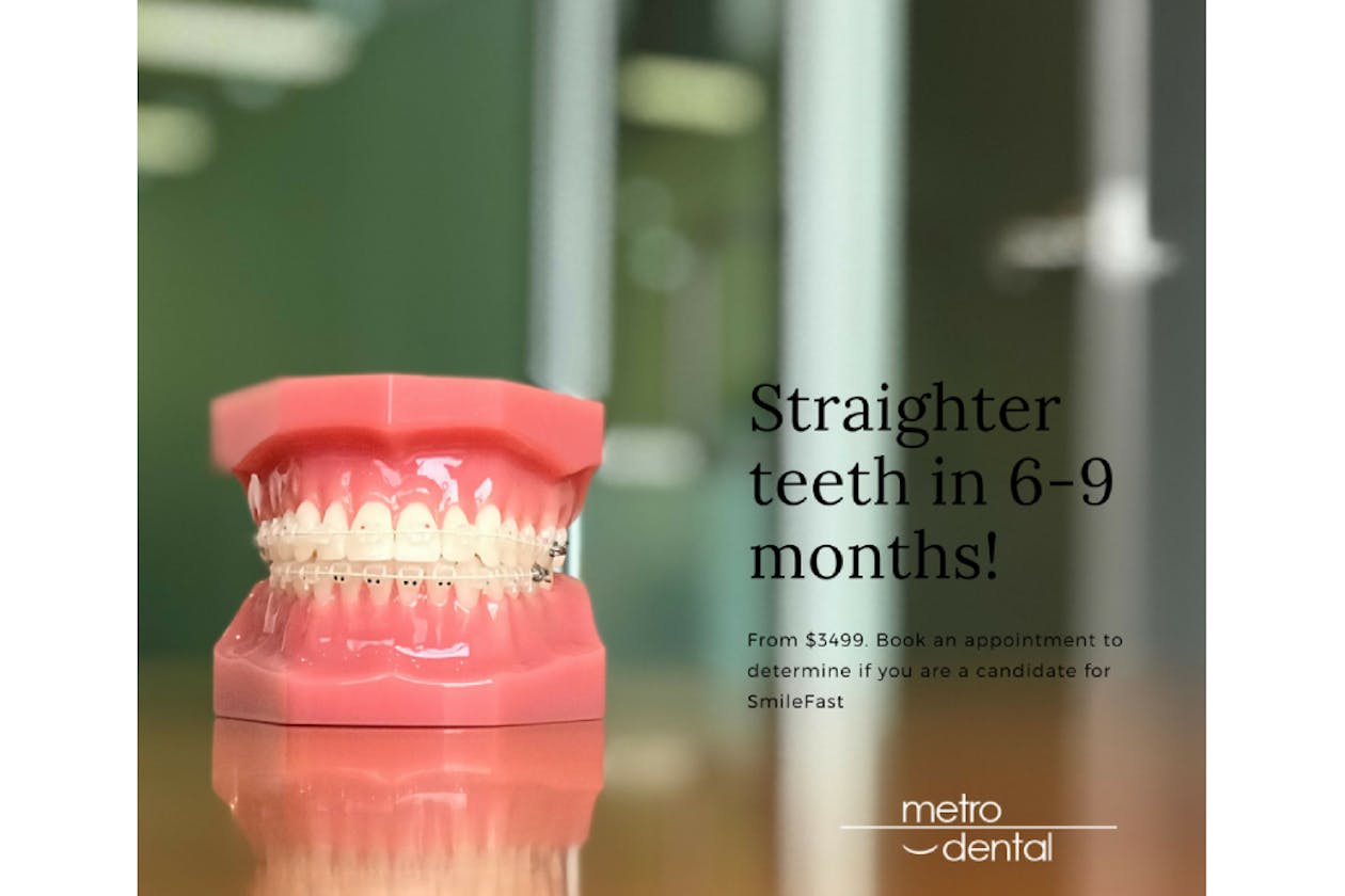 Metro Dental image 4