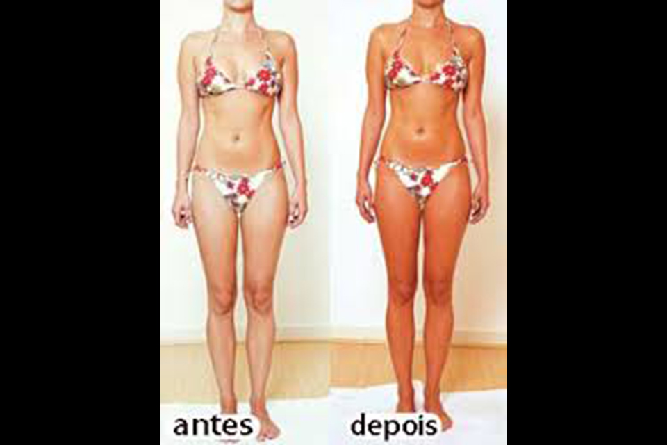 Glow Skin Treatment image 23