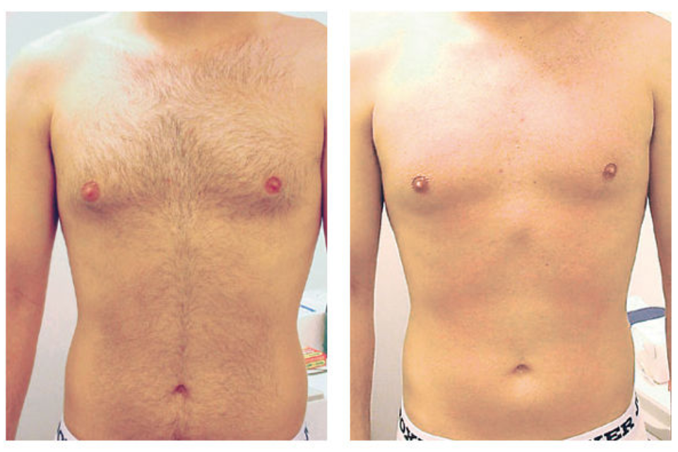 Hills Laser & Beauty image 4