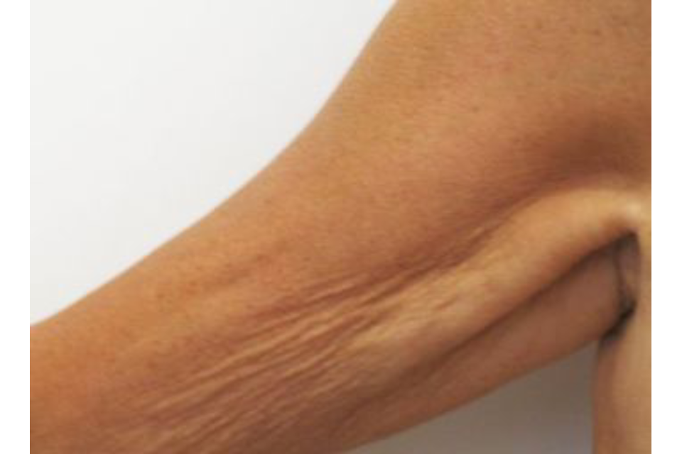 Hills Laser & Beauty image 8