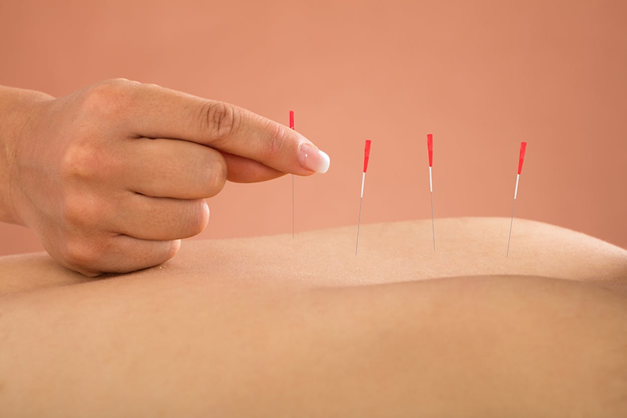 Bondi Massage and Acupuncture image 1