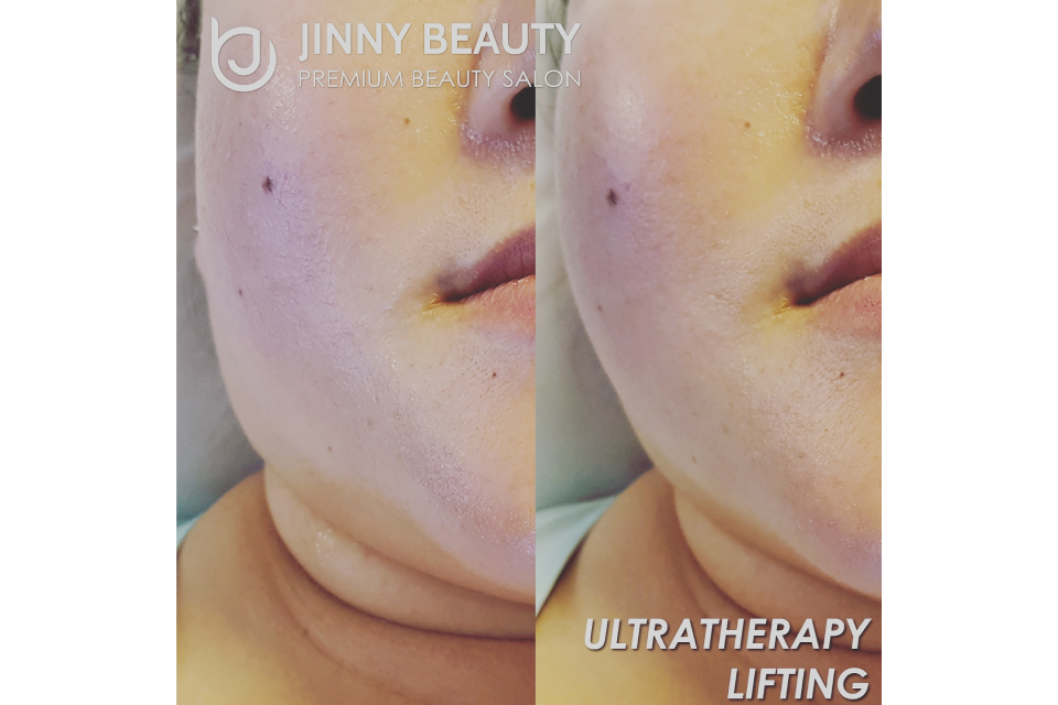 Jinny Beauty image 11