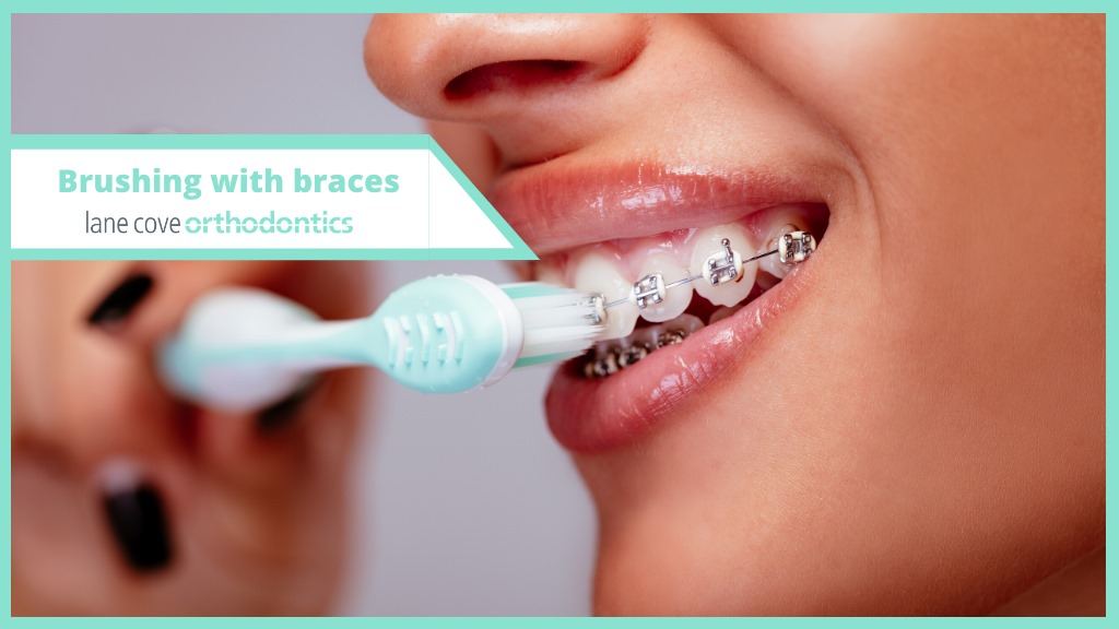 Lane Cove Orthodontics image 4