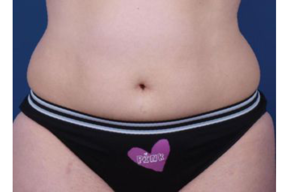 Hills Laser & Beauty image 7