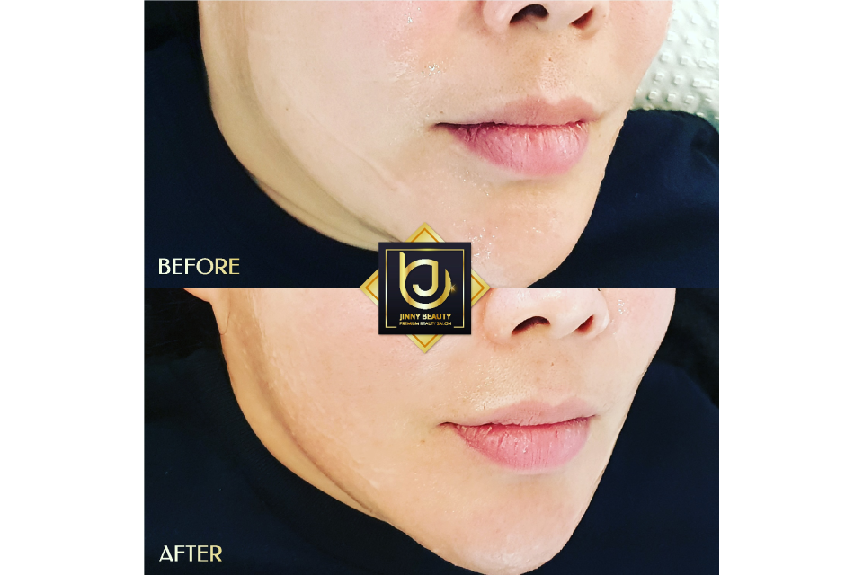 Jinny Beauty image 5