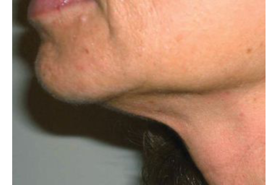 Hills Laser & Beauty image 11