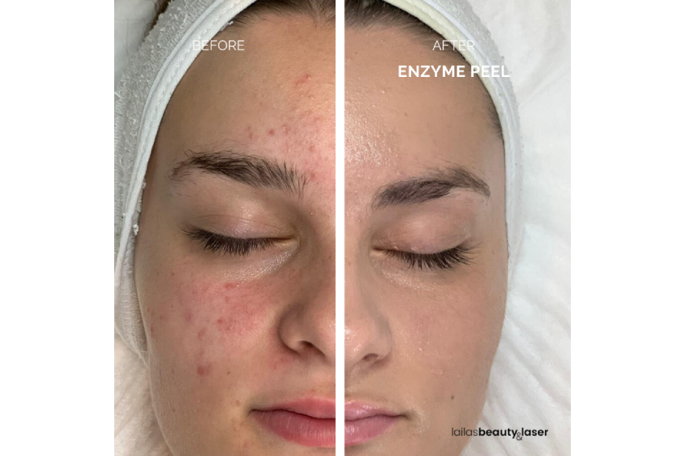 Laila’s Beauty & Laser image 4