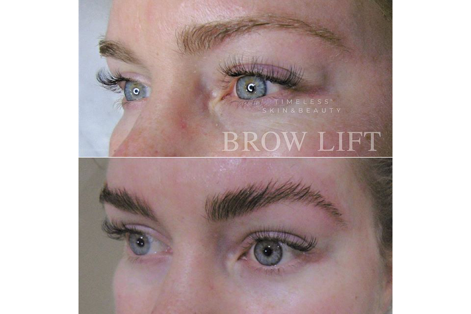 Timeless Skin & Beauty - North Beach image 5