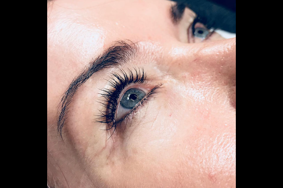 LaserSkin Specialist image 30