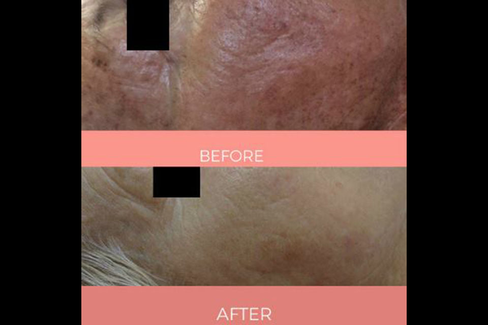 LaserSkin Specialist image 28