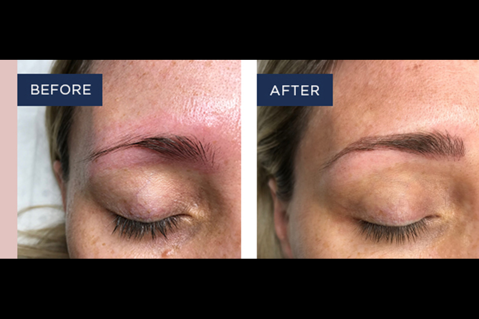 LaserSkin Specialist image 26