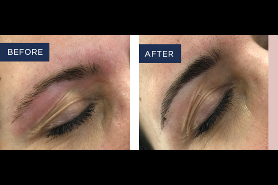 LaserSkin Specialist image 25