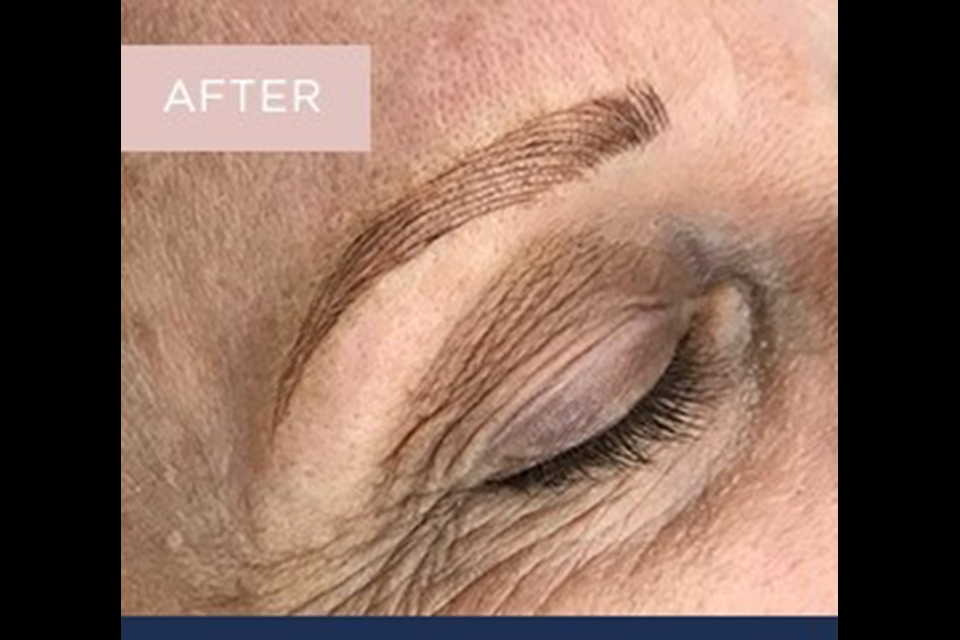 LaserSkin Specialist image 24