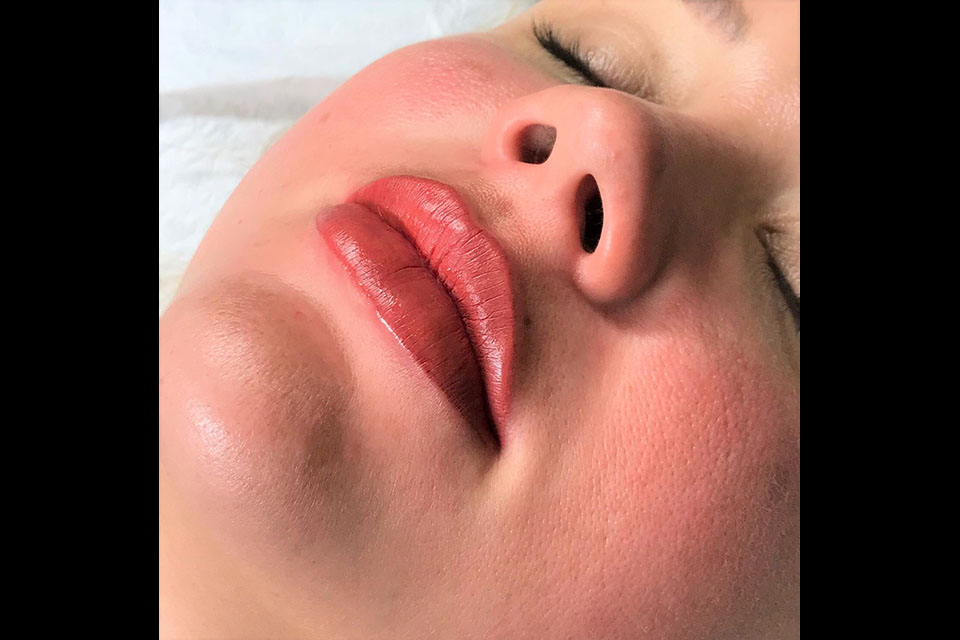 LaserSkin Specialist image 33