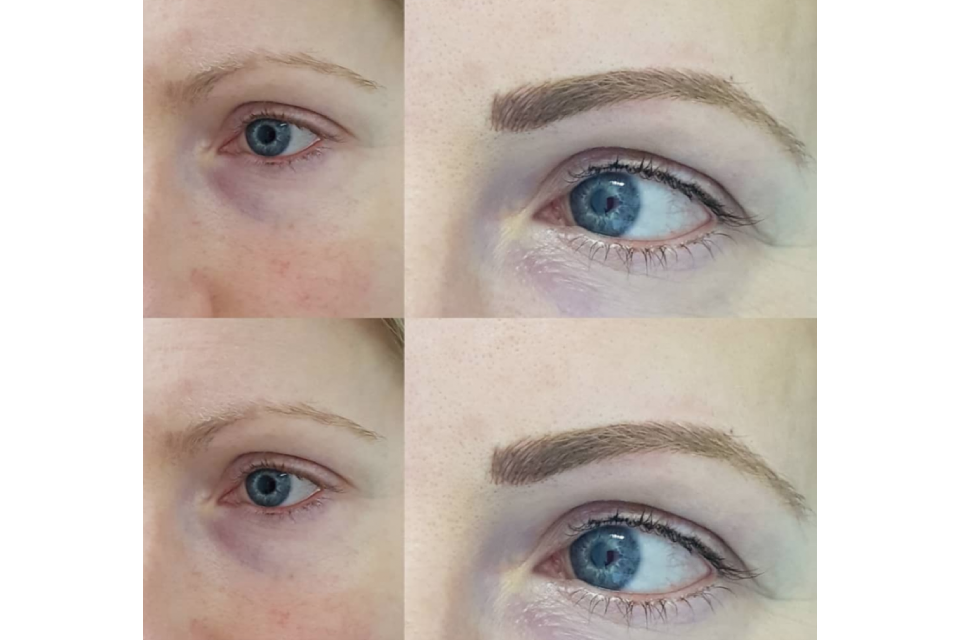 Norwest Laser Centre image 3