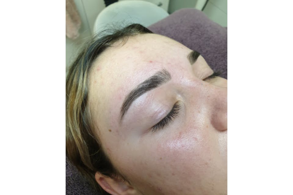 Bellissima Skin and Beauty Joondalup Face treatments Facial