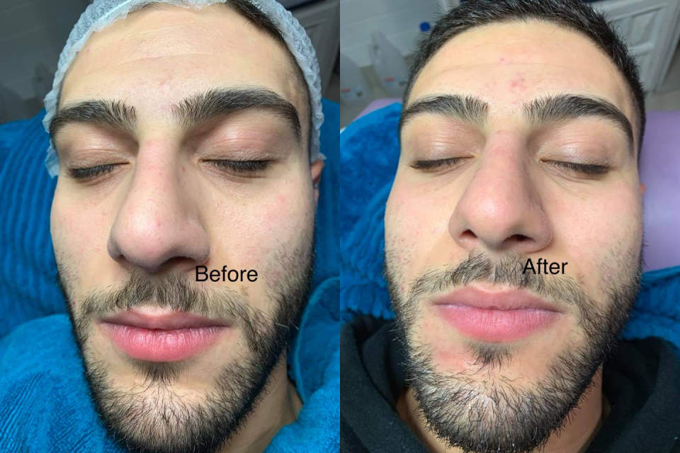 Moonlight Therapy image 6