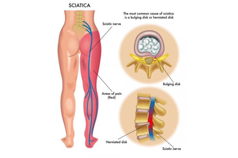 Nathan Burns Acupuncture & Massage - Elsternwick image 6