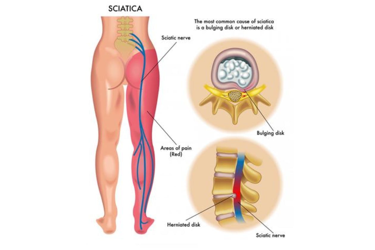 Nathan Burns Acupuncture & Massage - Elsternwick image 6