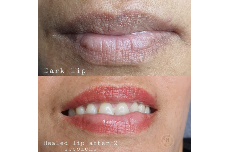 In2Skin Beauty & Dermal Therapy image 21