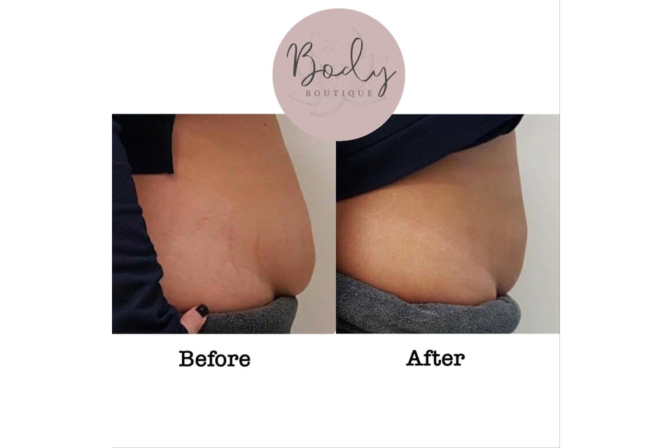 Body Boutique Gippsland image 4