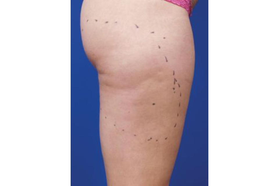 Hills Laser & Beauty image 5