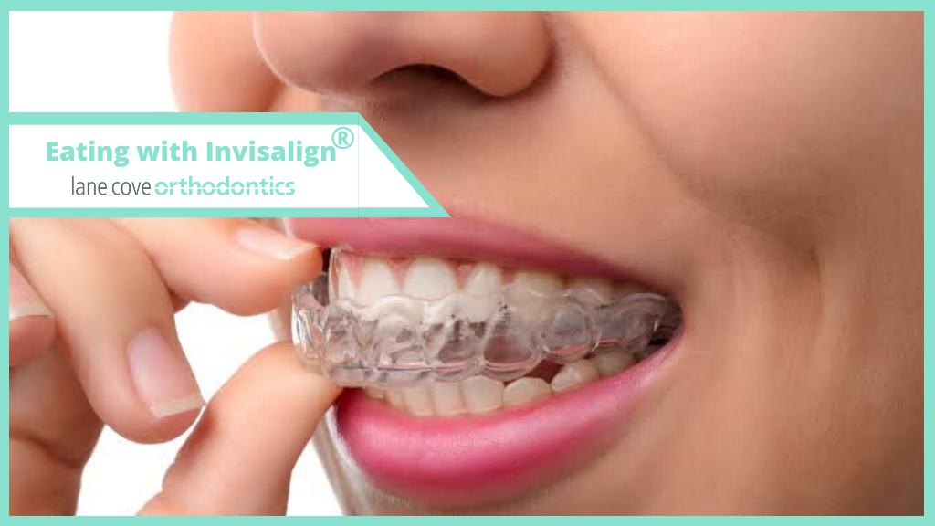 Lane Cove Orthodontics image 5