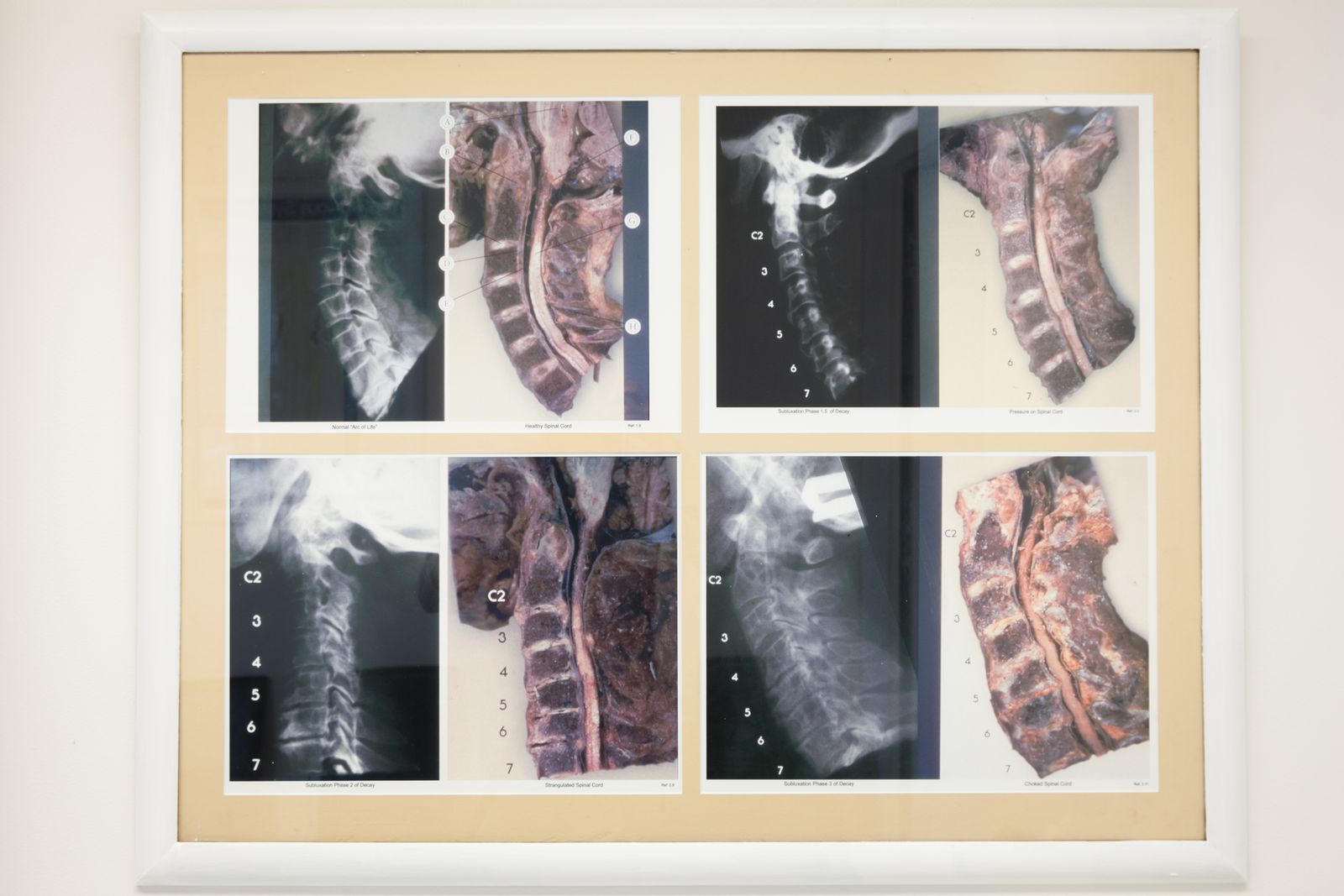 Chiropractic Central Lane Cove image 16