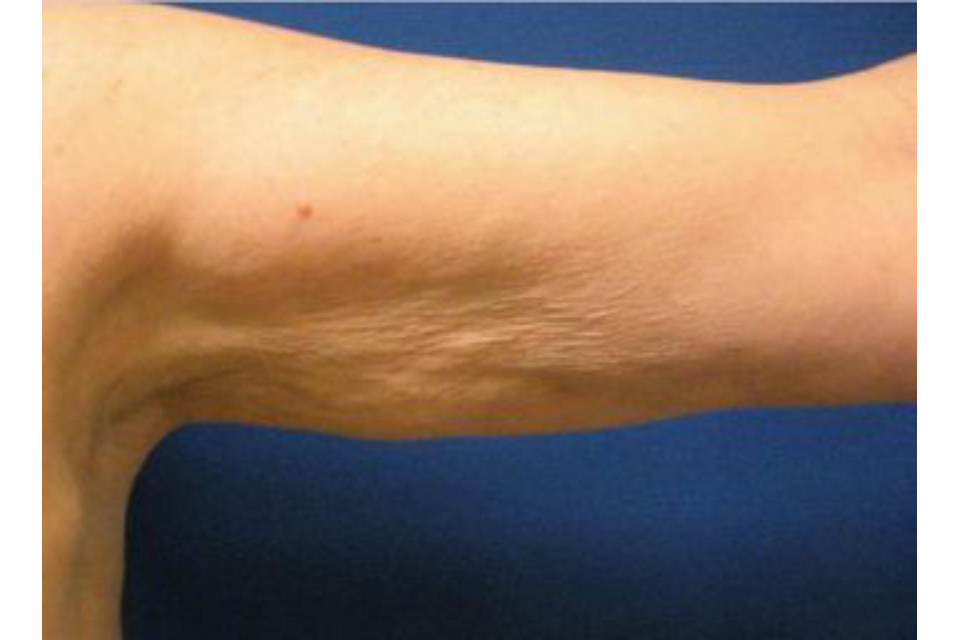 Hills Laser & Beauty image 9