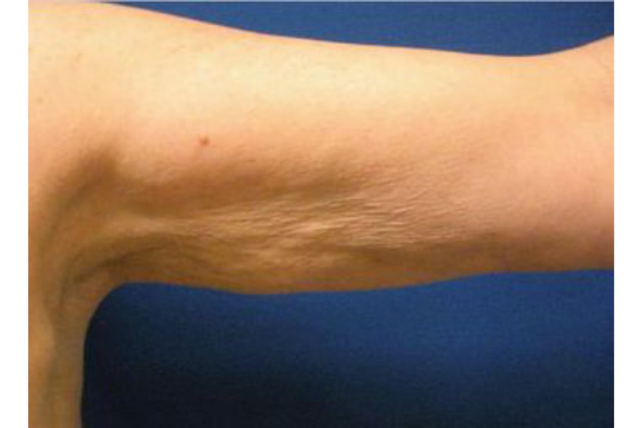 Hills Laser & Beauty image 9