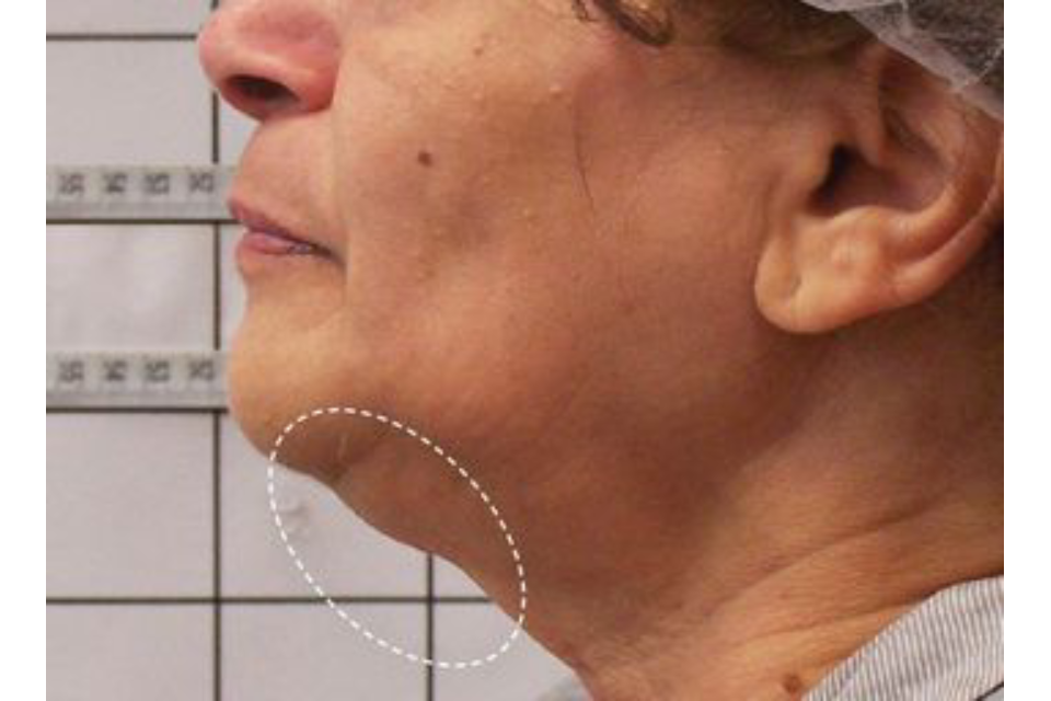 Hills Laser & Beauty image 10